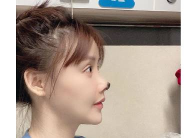 31岁美女明星整容失败惨毁容 院方：在走司法程序